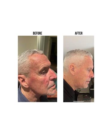 SOLURETINOL Anti-Aging Serum - Premium Skincare for Youthful Skin | Shop Internationally - Buy Online on GoSupps.com