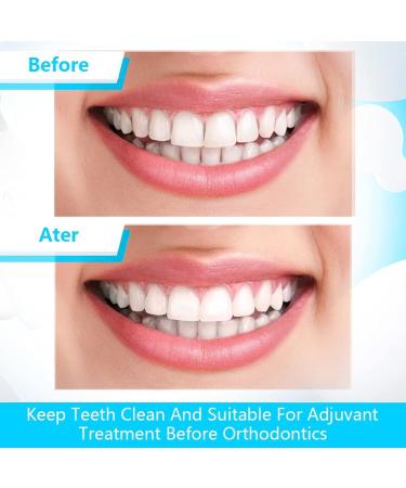 Buy Lsojfe Tooth Sandpaper - Ultra-Fine Dental Polishing Strips (20 m 4mm Width) | Interdental Grinding Tool for Optimal Oral Care - Buy Online on GoSupps.com