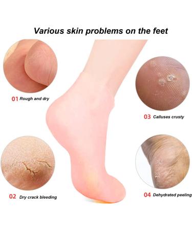 Moisturizing Gel Socks - 2 Pack | Elastic Foot Care Spa Socks for Dry Cracked Feet - Buy Online on GoSupps.com