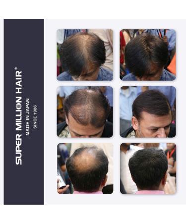 Super Million Hair 15g - No.2 Dark Brown: Instant Hair Loss Concealer - Buy Online on GoSupps.com