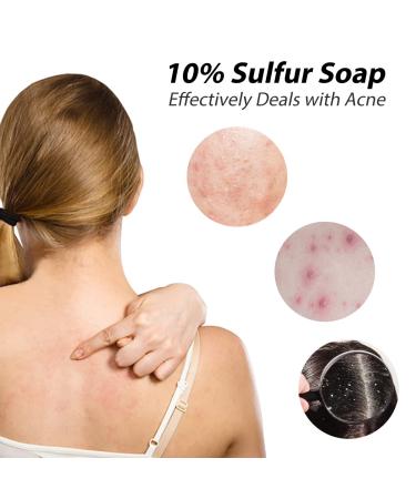 BEE & FLOWER Shanghai 10% Sulfur Soap Bar 3.4 Oz (Pack of 6) - Face and Body Soaps - Buy Online on GoSupps.com