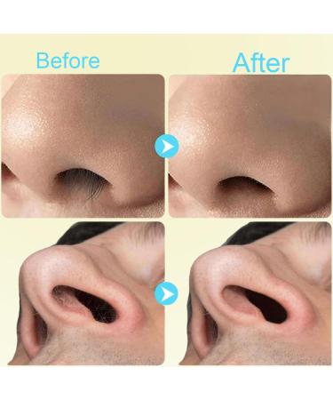 2-in-1 Nasal Hair Cutter - 2024 Double-Sided Nose Hair Trimmer & Ear Spoon | 360 Rotating Manual Shaver for Men & Women - Portable & Efficient (White - Buy Online on GoSupps.com