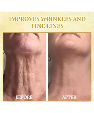 Skin Firming Oil Skin Firming Oil Hyaluronic Acid Body Oil Collagen Lifting Moisturizing Face Oil Refreshing Non Sticky - Buy Online on GoSupps.com