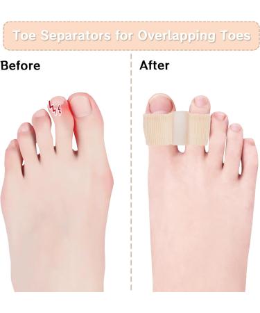 12 Pack Toe Spacers for Overlapping Toes - Toe Separators for Bunion and Hammertoe Straightening - Buy Online on GoSupps.com