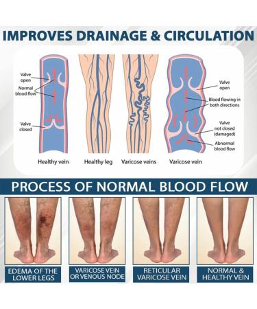 ATTDX Black Cumin Herbal Cream Effectively reduce leg discomfort (3) - Buy Online on GoSupps.com