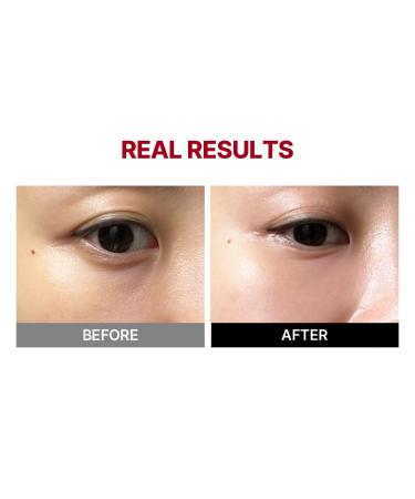 Buy MEDITHERAPY Mega Under Eye Masks - 4 Pairs | Korean Eye Mask for Puffiness Dark Circles & Wrinkles | Best Anti-Wrinkle Skincare Online - Buy Online on GoSupps.com