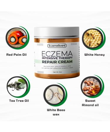 EczemaGuard Hand Eczema Cream - Natural Relief for Kids & Adults | Hypoallergenic Moisturizer for Sensitive Skin | 6oz Itchy Skin Calming Cream - Buy Online on GoSupps.com