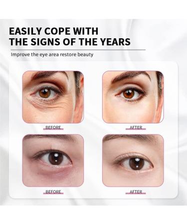 Eye Lifting Serum Mango Revitalizing Eye Cream Remove 99% of Eye Bags & Dark Circles Firm Skin Moisturize & Smooth - Buy Online on GoSupps.com