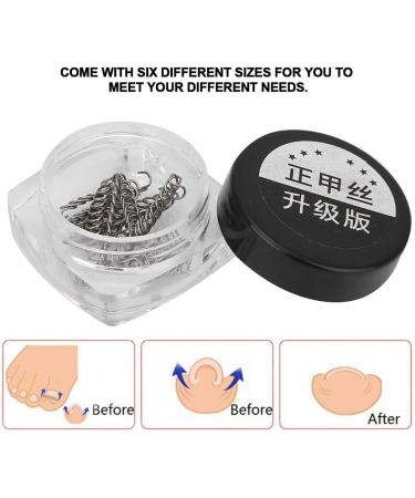 Ingrown Toe Wire Fixer 2 Box Fixer Toenail Correction Corrector Lifter Tool Nail Ingrowing Pedicure Care with 6 Sizes for Nail Toe Straighteners Recover Foot Care Men and Women - Buy Online on GoSupps.com