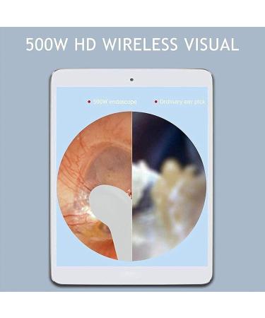 SMSOM Ear Wax Removal Tool Earwax Removal Camera 1080P HD Wireless Ear Endoscope Wax Removal with 6 LED Lights Otoscope Ear Wax Removal Compatible with Smart Phones (Black) - Buy Online on GoSupps.com