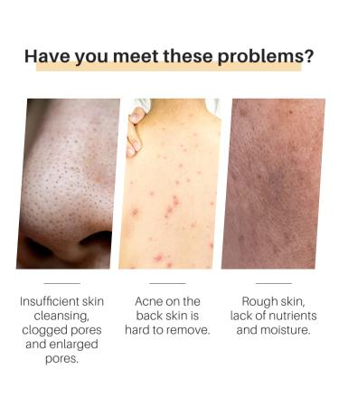 Organic Turmeric Soap Bar - Natural Face & Body Cleanser with Vitamin E Coconut & Almond Oil | 3.53oz Handmade for Acne & Smooth Skin - Buy Online on GoSupps.com