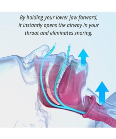 Zcomfort Snoring Aid Z Comfort Anti Snore Mouth Guard Zcomfort Snoring Mouthpiece Zcomfort Anti Snoring Mouthguard Snoring Mouth Guard Sleep Better Anti Snoring Devices for Men & Women (1Pcs) - Buy Online on GoSupps.com