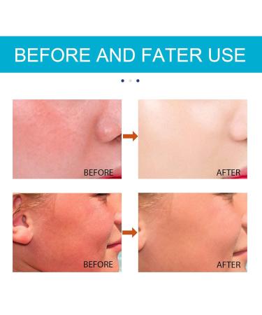 Joseon Matte Korean Sunscreen Stick SPF50 PA++++ | Relief Organic 2-Pack | All Skin Types - Buy Online on GoSupps.com