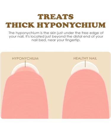 NailGrowth DeepHealing Organic Serum NailGrowth Nail Serum Reconstrux Nail Growth Nail Growth and Strengthening Serum Nail Serum for Growth and Repair for Damaged Nails (3pcs) - Buy Online on GoSupps.com