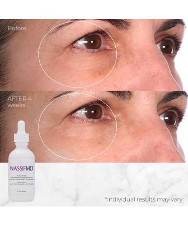 NassifMD Niacinamide Serum 10% with Cranberry Biopeptides and Ectoin Brightening and Hydrating Vitamin B3 Face Serum Evens Tone Smooths Texture Reduces Fine Lines Boosts Radiance - Buy Online on GoSupps.com