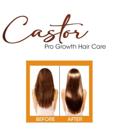 Buy Difeel Essentials Pro-Growth Castor Hair Mist 6 oz | Nourish & Strengthen Hair | Fast International Shipping - Buy Online on GoSupps.com