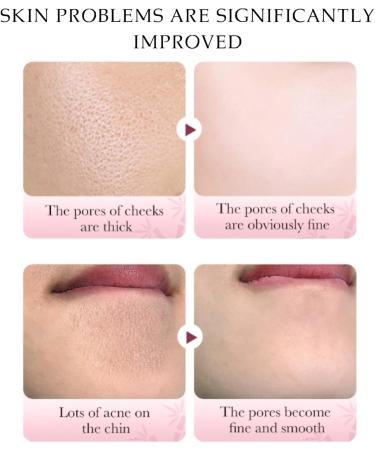 Pink Clay Mask - Face Masks Skincare for Women - Mud Mask for Pore Clearing - Mud Face Mask for Deep Cleansing Refining Pores - Reduce Acne & Dark Spots - Buy Online on GoSupps.com