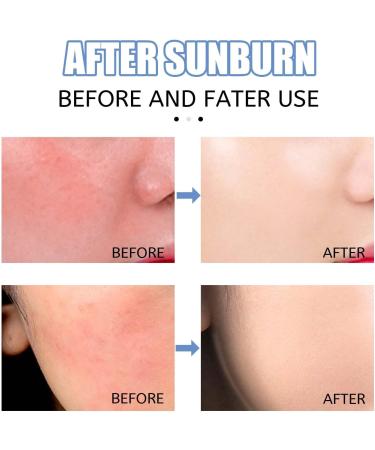  Lambo After-Sun Milk - Organic Moisturizing Cream Soothing and Hydrating Repairs Sunburn and Scars | Aloe Vera Gel for Face Hair and Body Lambo - Buy Online on GoSupps.com