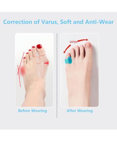 Fadbuds 6 Pairs Toe Separators for Overlapping Toes Gel Hallux Valgus Big Toe Straightener Protector Splint Blue Clear Gel Straighteners Reusable Big Toe Spacers for Women Men Bent Toes Pain Relief - Buy Online on GoSupps.com