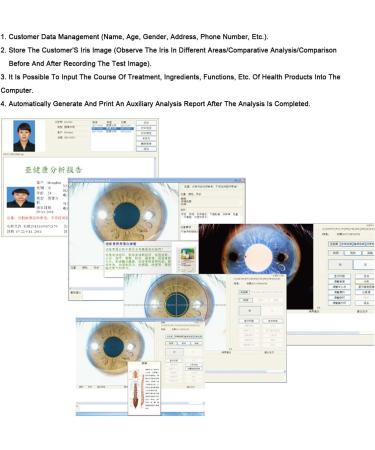 Iridology Camera - 3D Iriscope Eye Analyzer | 8MP HD Lens Double Screen | Ideal for Beauty Salons & Hospitals - International Shipping Available - Buy Online on GoSupps.com