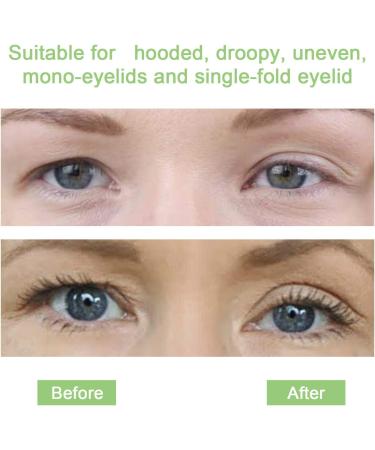 Eyelid Tape (5MM) | Eyelid Lifting Stripes for Hooded Eyes | Invisible Eyelid Correcting Tapes for Droopy Eyes | No Surgery and 24h Stay | Makeup Compliant Easy To Apply 5MM Single-sided Sticky Skin Tone ZF - Buy Online on GoSupps.com