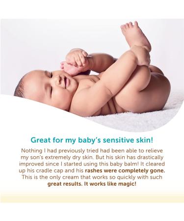 Organic Cradle Cap & Eczema Treatment - Calendula Cream with Manuka Honey & Lavender - Baby Skin Care (2oz) - Buy Online on GoSupps.com