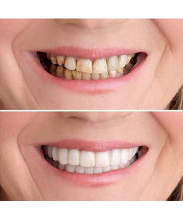 Temporary Dentures: Comfortable & Natural Fake Teeth for Confident Smiles (Size 1) - Buy Online on GoSupps.com