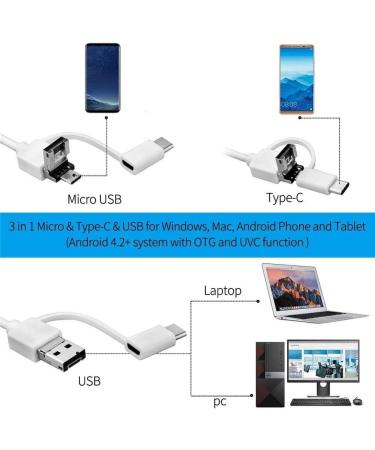 KouRy Ear Cleaning Endoscope Otoscope - 5.5 mm HD Ear Wax Removal Kit- Wireless Smart Phone Otoscope-WiFi Visual Ear Cleaner Camera with 6 LED Lights Compatible with Smart Phones & Tablets - Buy Online on GoSupps.com