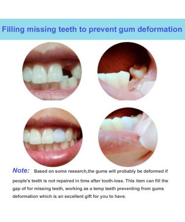 False Tooth Repair Kit with Thermal Fitting Beads - Snap On Instant Smile - Denture Adhesive - Buy Online on GoSupps.com