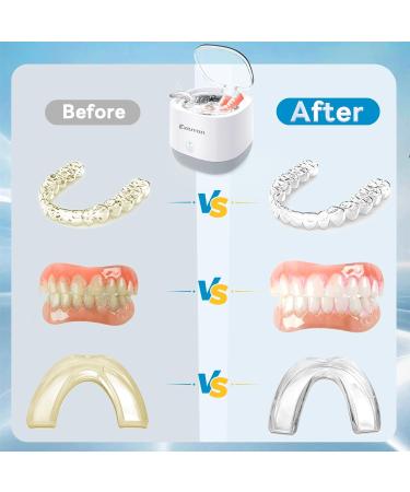 Exluvon 45kHz Ultrasonic Retainer Cleaner: Dental Machine for Dentures, Retainer, Aligner, Mouthguard, Invisalign, Whitening Trays & Jewelry - 250ML - Buy Online on GoSupps.com