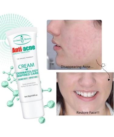 Salicylic Acid Face Moisturizer - Face Cream for Women - Acne Repair Face Cream - Spot Cream for Acne & Pimple - Moisturizer Face with Salicylic Acid - Improves Acne & Brightens Skin 20g - Buy Online on GoSupps.com