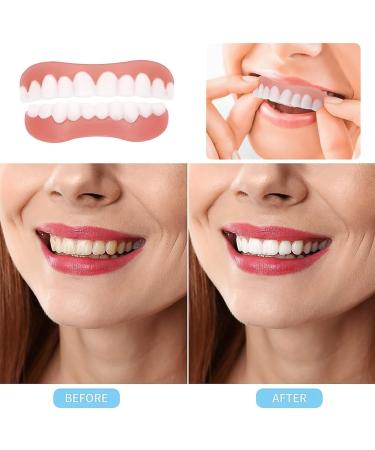 Wttfc Clipin veneers 2 pairs of false teeth veneers direct dentures adjustable click dentures clickin veneers false teeth for women and men teeth whitening covering imperfect teeth - Buy Online on GoSupps.com