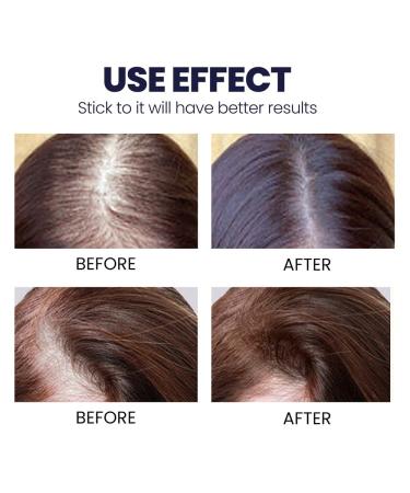 Blossoms Hair Growth Serum Spray - Densifique Formula for Fast Hair Growth with Ashwagandha - 2pcs - Buy Online on GoSupps.com