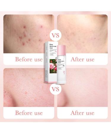 Rose Toner for Face Rose Water for Face with 98% Rose & Hyaluronic Acid Moisturizing Toner Vegan Rose Water for Women Korean Toner Skincare Nourishing - Buy Online on GoSupps.com