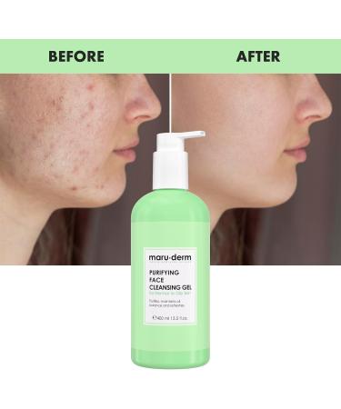 Maruderm Facial Cleansing Gel with Salicylic Acid Specially Designed for Combination and Oily Skin 400 ML - Buy Online on GoSupps.com