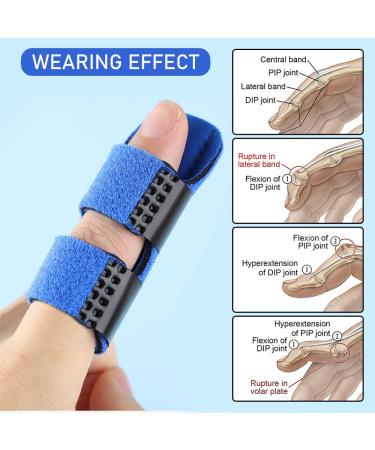 4PCS Ouzhou Trigger Finger Splint for Stenosing Tenosynovitis - Pain Relief & Finger Straightening Support - Buy Online on GoSupps.com