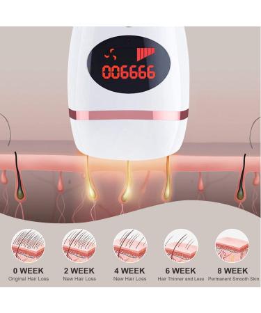 Professional Grade Laser Hair Removal Device | 999,900 Flashes | Permanent At-Home IPL for Women and Men | Ideal for Facial, Bikini Line, Armpits, and Whole Body - Buy Online on GoSupps.com