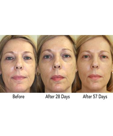 RejuveMD Growth Factor Anti-Aging Eye Serum - 0.5 Fl oz - Buy Online on GoSupps.com