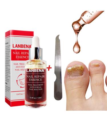 Beito 1PC Nail Repairs Solution de renouvellement des ongles l'huile essentielle tue les ongles fongiques Traitement fongique pour ongles cassants et craquel s (12ML)