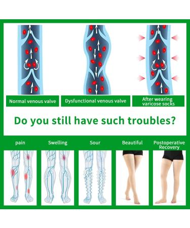 Buy VARCOH Plus Size Compression Socks for Women - Thigh High Open Toe 20-30 mmHg for DVT Pregnancy Varicose Veins & Edema - Large Beige - International Shipping Available - Buy Online on GoSupps.com