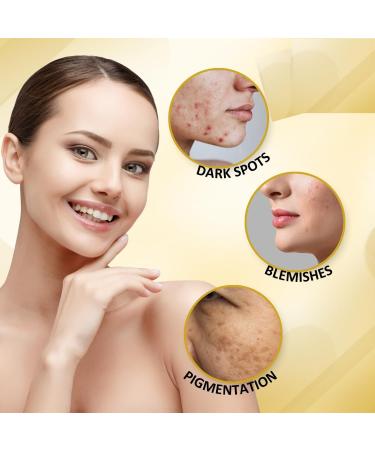 Goldy Dark Spot Corrector Cream - Remove Dark Spots Blemishes & Scars with Saffron & Green Tea | 50 gm - Buy Online on GoSupps.com