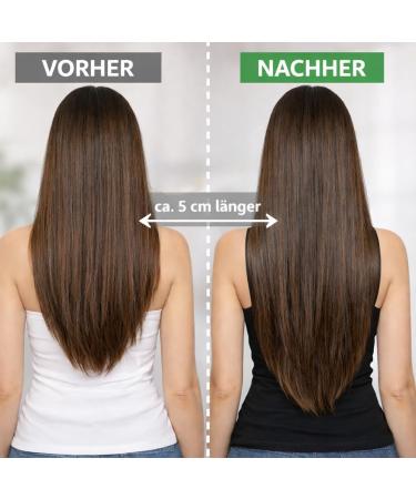 Veana Haarwachstums - Shampoo Vital DeLuxe (250-1000ml) - Haarausfall stoppen Haarwachstum reaktivieren Gr ße 500ml 1 ml (Lot de 1) - Buy Online on GoSupps.com