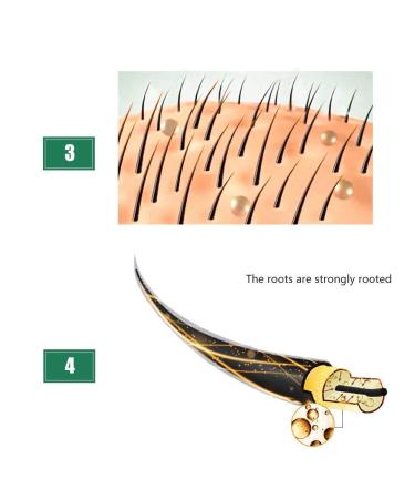 Advanced Hair Growth Serum - Accelerate Growth Thicken & Regrow Hair Anti-Hair Loss Treatment for Thin Hair - Buy Online on GoSupps.com