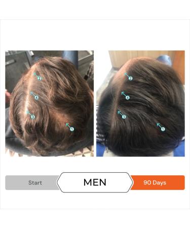 DS Laboratories Revita Conditioner - Hair Growth & Thickening Conditioner for Fine Hair Travel Size 3.38 Fl Oz Best for Hair Loss - International Shipping Available - Buy Online on GoSupps.com