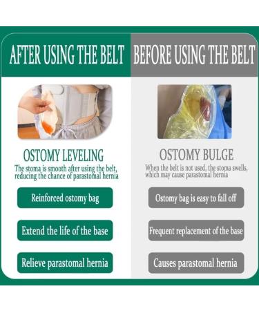 Ostomy Support Belt | Adjustable Stoma & Colostomy Belt | Protective Ileostomy Belt (Grey L 36.8in-42in) - International Shipping Available - Buy Online on GoSupps.com