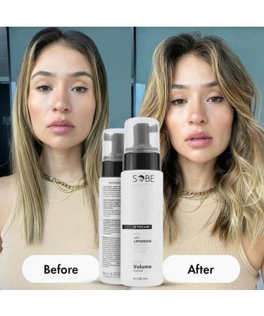 SOBE LUXE Hair Volumizing Mousse 8 Oz | Lifts Adds Volume & Texture | Infused with Calendula Sunflower Oil Vitamin E & Peptides - International Shipping Available - Buy Online on GoSupps.com