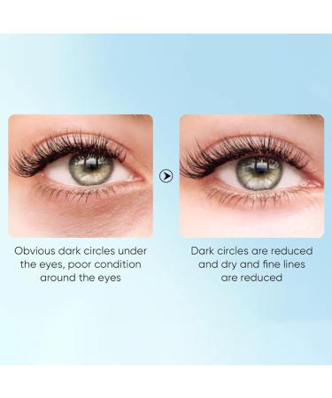Aloe Vera Eye Cream - Anti-Aging Moisturizing Eye Care for Dark Circles & Wrinkles | Hydrating 20g (5 Pieces) - Buy Online on GoSupps.com