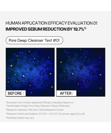 Parnell Apple Vinegar Pore Deep Cleanser Gentle Face Wash with Apple Extract & Baking Soda Removes Sebum & Impurities Pore Control Foam Cleanser for Oily & Acne-Prone Skin 5.07 fl oz / 150ml - Buy Online on GoSupps.com