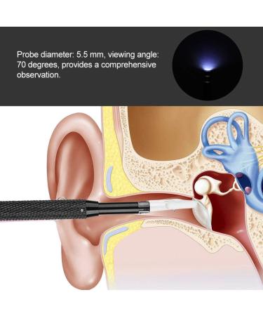 Earwax Removal Kit with Camera | Home Ear Cleaning Tool - Buy Online on GoSupps.com