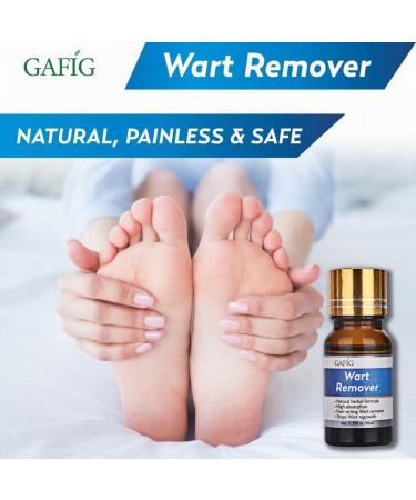 Gafig Wart Remover - Painlessly Removes Common Hand and Plantar Warts - Maximum Strength Liquid Treatment - Buy Online on GoSupps.com